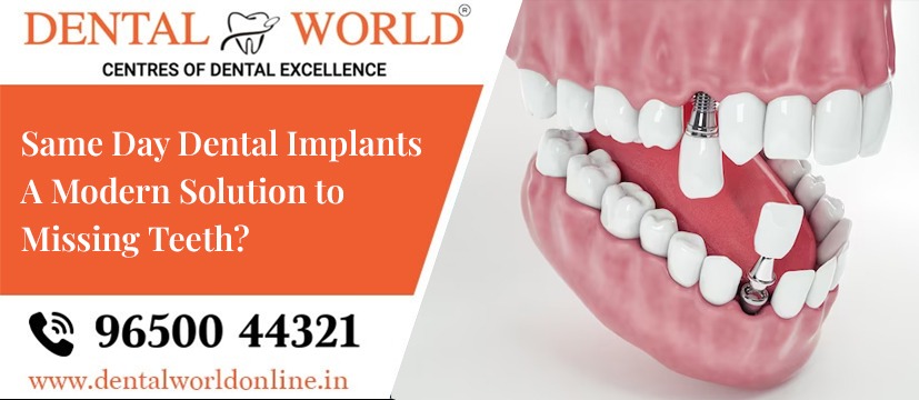 Denta Crest provide same day dental implants, a modern solution to missing teeth